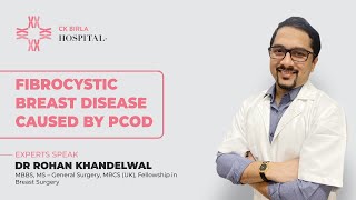 Fibrocystic Breast Disease Caused by PCOD  Dr Rohan Khandelwal  CK Birla Hospital [upl. by Aleece881]