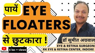 What are Eye Floaters  आई फ्लोटर्स से पाएं छुटकारा [upl. by Retrop874]