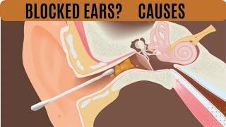 quotBlocked Ears Unveiled 5 Surprising Causes You Never Knew Aboutquot English [upl. by Sadoff]