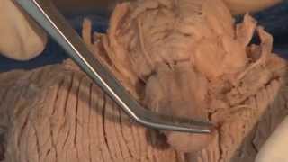 Cranial Nerves Neuroanatomy Video Lab  Brain Dissections [upl. by Anya]