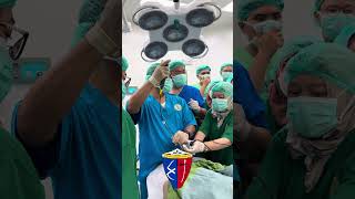 Flexible Endoscopic Intubation Hangup airway airwaymanagement [upl. by Immac]