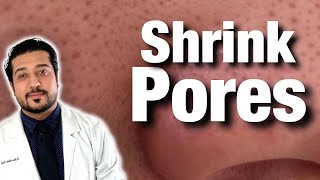 How to Shrink Pores For Good  Get Rid of Pores on Nose FAST 2021 [upl. by Epillihp]