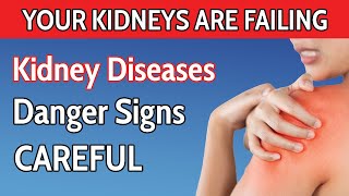 SAVE YOUR KIDNEY STRANGE 8 Signs Your Kidneys Are Crying for Help [upl. by Cochrane]