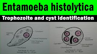 Entamoeba histolytica trophozoite and cyst  microscopic view with identification features [upl. by Alvera270]