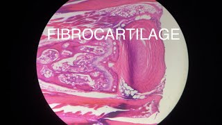 FIBROCARTILAGE [upl. by Otrebogir55]