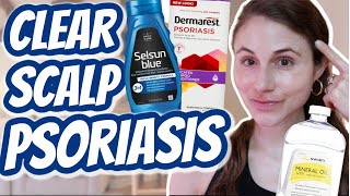 How to CLEAR SCALP PSORIASIS Dr Dray [upl. by Hewet]