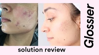 Glossier Solution Review [upl. by Notnil646]