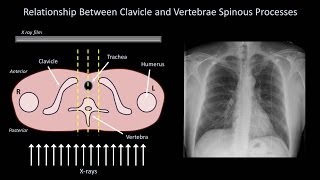 How to Interpret a Chest XRay Lesson 3  Assessing Technical Quality [upl. by Kalli]