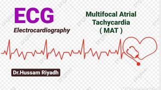 Lec 5 ECG  multifocal atrial tachycardia MAT  DrHussam Riyadh [upl. by Nochur]