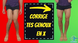 genou en x ou valgus  exercice kiné pour le corriger [upl. by Jefferey]