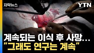 자막뉴스 임상 규모 늘려야 100년 넘는 실패 이유  YTN [upl. by Airahs487]