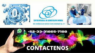 Discolisis cervical con ozono en Guadalajara JaliscoMexico [upl. by Musser852]