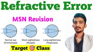 Refractive Errors  Hypermetropia  Myopia  Astigmatism  MSN Important Topic Eye MSN [upl. by Oivaf]