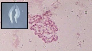 Identifying characters of polytene chromosome of Drosophila sp [upl. by Emlynne]