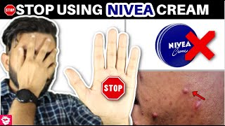 NIVEA CREAM REVIEW  STOP USING THIS⛔  QUALITYMANTRA [upl. by Yelich]