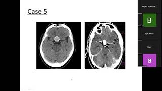 CNS Spotting lecture 2 part 1 [upl. by Luttrell937]