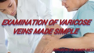 Examination Of Varicose VeinsTrendelenburg TestModified perthes Test and Feegan Test Made Simple [upl. by Reeta]