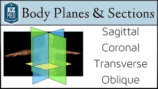 EASY TRICKS for Anatomical Body Planes and Sections DirectionPosition [upl. by Milda]