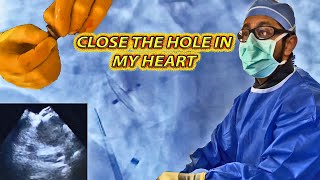 Closing the Hole in My Heart PFO Closure WITHOUT Open Surgery [upl. by Orvas]