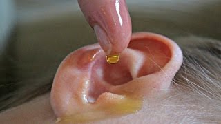 Natural Remedies for Ear Infection [upl. by Nameloc]