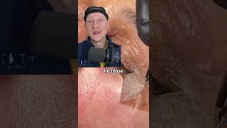 Chemical Peel Skin PEELING  Plastic Surgeon Reacts [upl. by Ellehsyt146]