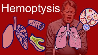 Hemoptysis Coughing Up Blood  Causes types symptoms [upl. by Jereme]