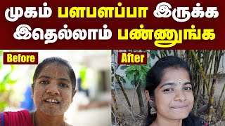 Pimple Solutions எந்நேரமும் முகம் பளபளப்பா இருக்கணும்னா இத பண்ணுங்க  Face Problem Solutions  TI [upl. by Adnaw]