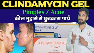 Clindamycin phosphate gel usp  कील मुंहासे Acne से छुटी  Pimples remove cream  Erytop gel [upl. by Hett465]