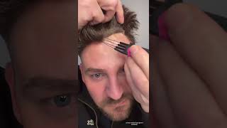 How to Use The Adhesive Remover  Hair System Beginner Must Watch [upl. by Idoux]