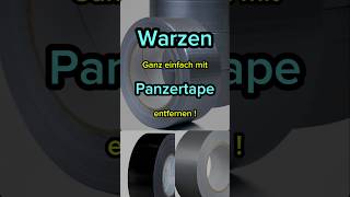 Warzen mit Panzertape entfernen gesundheit tips diy beauty fyp haut fürdich [upl. by Aikel]