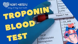 All About the Troponin Blood Test [upl. by Leventhal288]