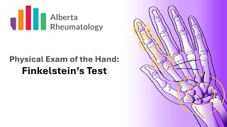 Rheumatology HAND exam Finkelsteins Test for DeQuervains Tenosynovitis [upl. by Jenny402]