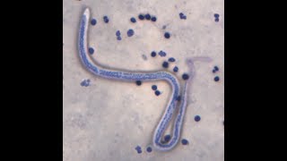 Microflilria MF of Wuchereria bancrofti under vital stained slide [upl. by Ode]