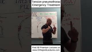 Tension pneumothorax emergency treatment shortvideo shorts drnajeeb drnajeeblectures [upl. by Yelsew]