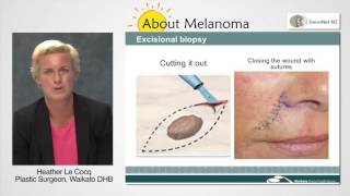 How Is Melanoma Removed [upl. by Akemak]