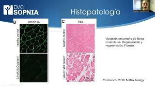 Curso Actualización en Enfermedades Neuromusculares Capítulo 3 [upl. by Ilaw]