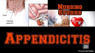 Complete lecture on Appendicitis  Pathophysiology  Medical Surgical nursingstudies [upl. by Anerbes]