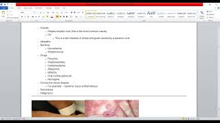 Plab 1 Lectures Dermatology Part 5 Erythema Multiforme [upl. by Imeaj]