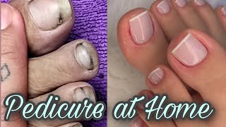 Pedicure at home Transformation from dirty to clean nails  Pedicure followingmydream [upl. by Volding]