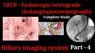 ERCP Procedure  Endoscopic retrograde cholangiopancreatography  biliary imaging system part 3 [upl. by Annairb]