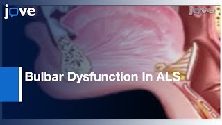 Comprehensive Assessment Bulbar Dysfunction In Amyotrophic Lateral Sclerosis l Protocol Preview [upl. by Storfer]