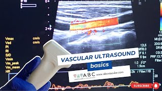 Vascular ultrasound basics [upl. by Ji243]