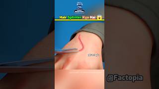 Remove Hair Splinter Immediately ⚠️ shorts fact splinter [upl. by Attekahs]