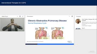 Interventional Therapies for COPD [upl. by Dolli]