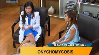 Good Morning Kuya Onychomycosis Fungal Nail Infection [upl. by Llemar564]