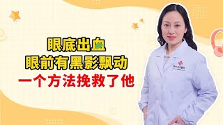 眼底出血 眼前有黑影飘动 一个方法挽救了他 [upl. by Henryson]