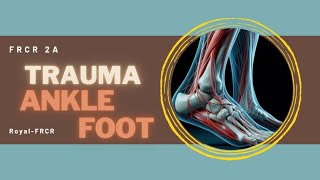 6  MSK amp Trauma Imaging for FRCR [upl. by Liva]