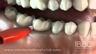 Interdental Brushing [upl. by Magnum]