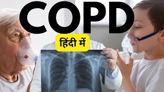 COPD symptoms treatment COPD in Hindi  COPD kya hai  COPD in Hindi [upl. by Ahsiened744]