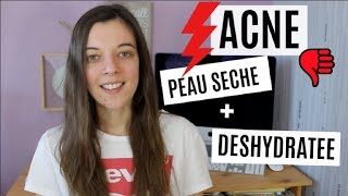 ACNE  Jai la Peau Sèche et Déshydratée AU SECOURS  😩 [upl. by Kleiman]